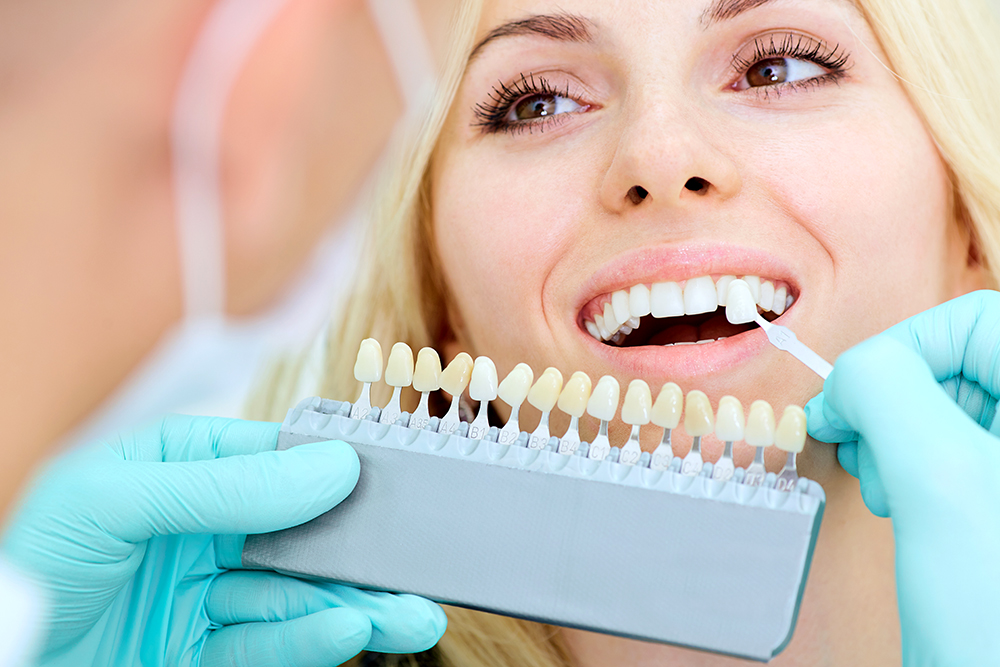 imagem de clareamento dental