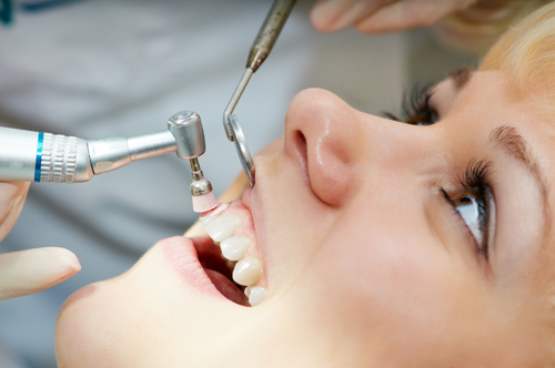 imagem de limpeza e prolixaxia dental